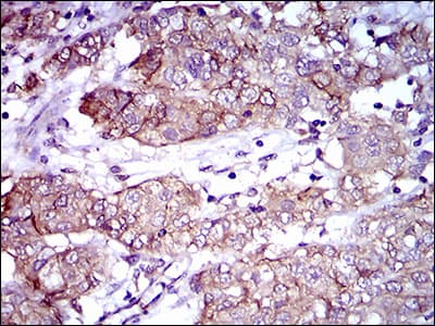 Monoclonal Mouse anti-Human ALCAM / CD166 Antibody (clone 8E12C7, aa48-216, IHC, IF, WB)