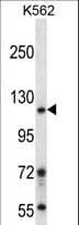 Polyclonal Rabbit anti-Human BRD1 Antibody (aa73-102, IHC, WB)