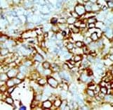 Polyclonal Rabbit anti-Human GCK / Germinal Center Kinase Antibody (aa288-319, IHC, WB)