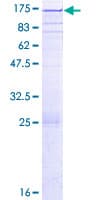 Human PARG Protein (Recombinant GST)