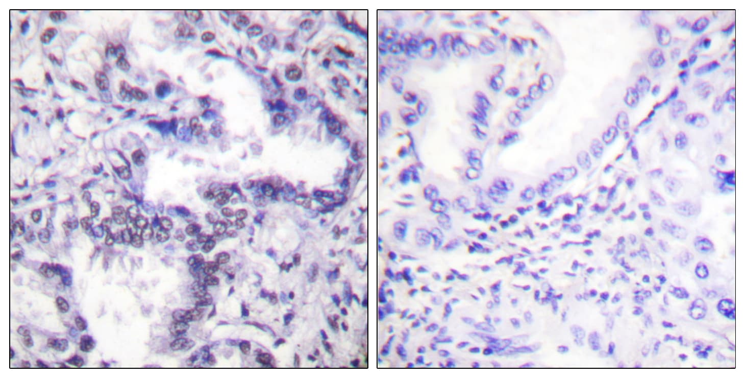 Polyclonal Rabbit anti-Human XRCC5 / Ku80 Antibody (phospho-Thr714, IHC, IF, WB)