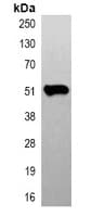 TUBB3 / Tubulin Beta 3 Antibody