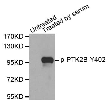 Polyclonal Rabbit anti-Human PTK2B / PYK2 Antibody (phospho-Tyr402, IHC, IF, WB)