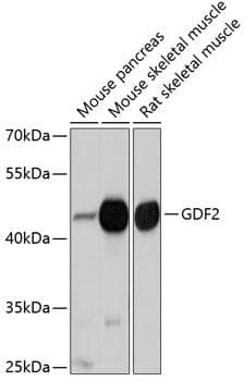 GDF2 / BMP9 Antibody