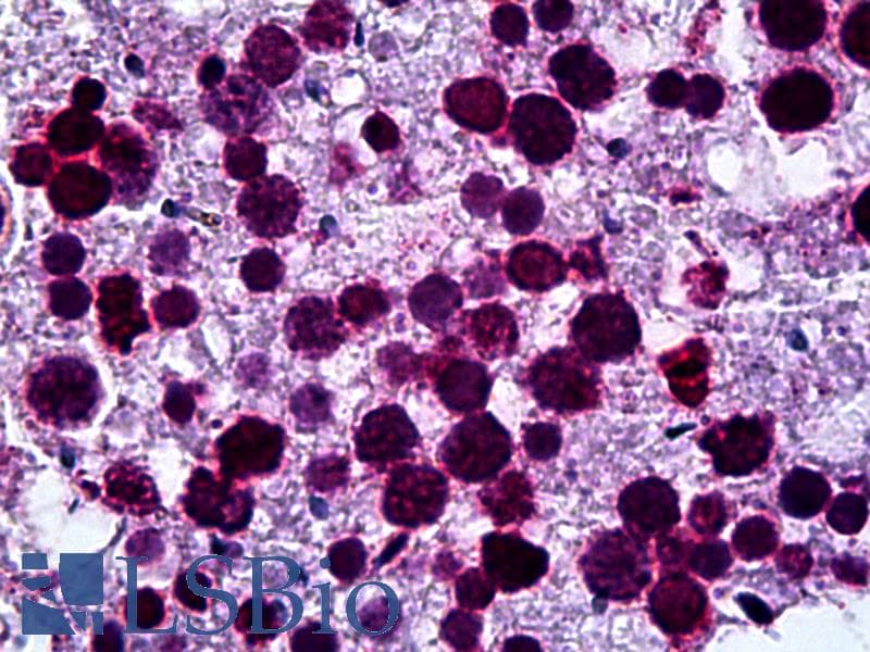 IHC-plus™ LMNB1 / Lamin B1 Antibody (clone 4E4)