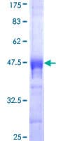 Human CDX4 Protein (Recombinant GST, N-terminus)