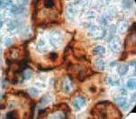 CD30 Antibody (clone Ber-H2, Ready-to-Use)