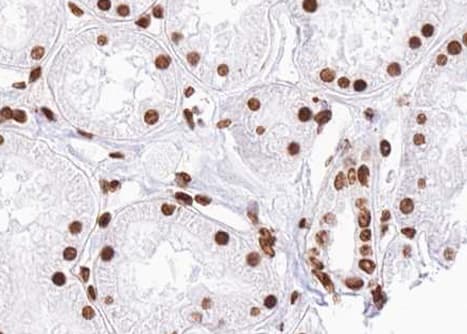 SMAD2 Antibody (phospho-Ser467)