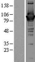 GBP1 Protein (Over-Expression Lysate Myc-DDK (Flag))