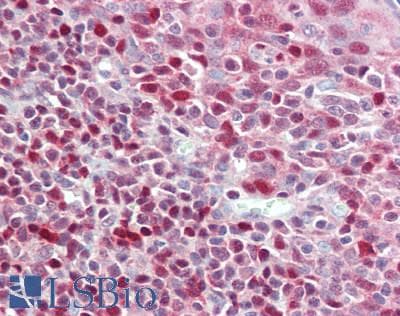 IHC-plus™ ADK / Adenosine Kinase Antibody (aa312-362)