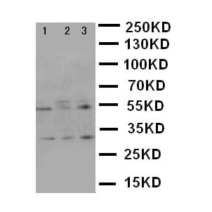 Polyclonal Rabbit anti-Human KLK2 / Kallikrein 2 Antibody (aa243-261, IHC, WB)