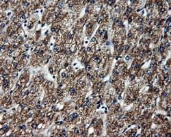 ATP5B / ATP Synthase Beta Antibody (clone OTI1B10)