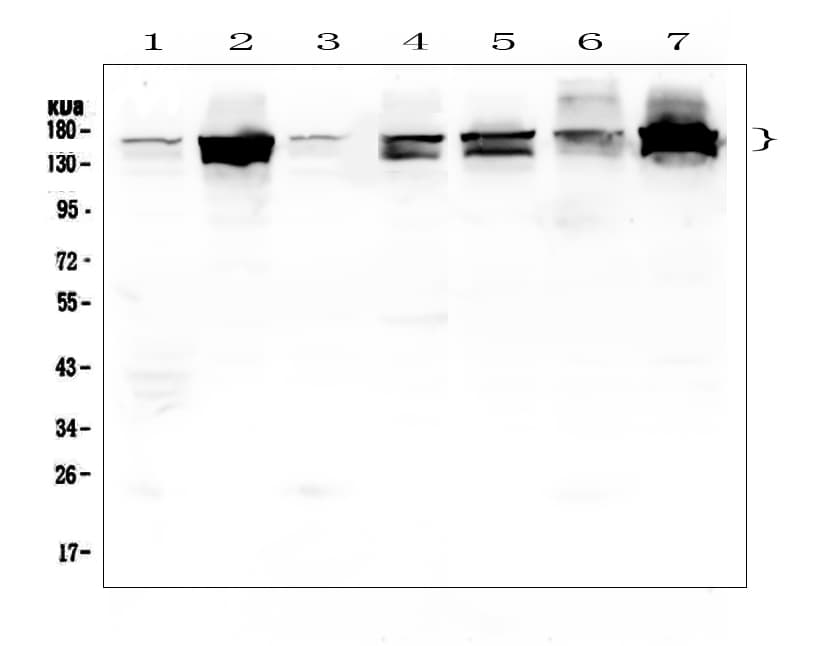 Polyclonal Rabbit anti-Human INPPL1 / SHIP2 Antibody (IHC, WB)