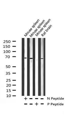 Polyclonal Rabbit anti-Human NF2 / Merlin Antibody (phospho-Ser518, IF, WB)