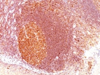 MALT1 Antibody (aa701-808, clone SPM578)