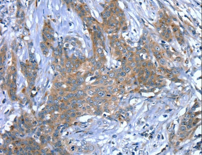 SCPEP1 / RISC Antibody