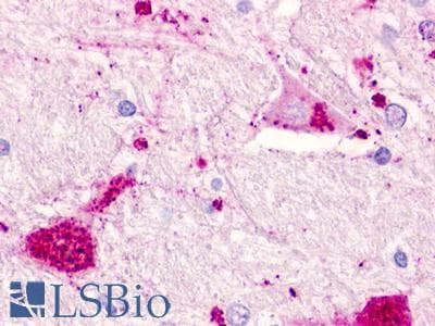 PathPlus™ CHEMR23 / CMKLR1 Antibody (N-Terminus)