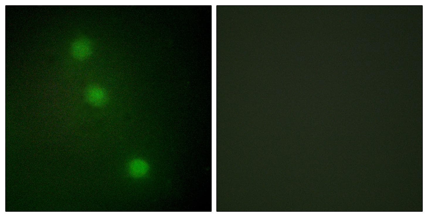 ATF1 Antibody