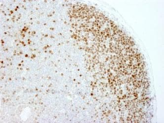 MKI67 / Ki67 Antibody (Internal)