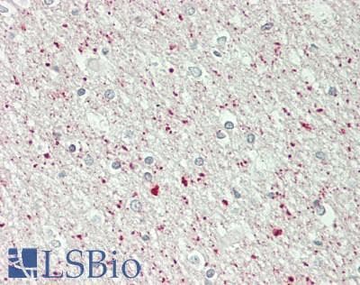 IHC-plus™ USP10 Antibody (aa50-100)