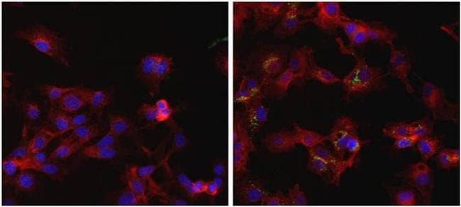 Ferritin Antibody (clone 101)
