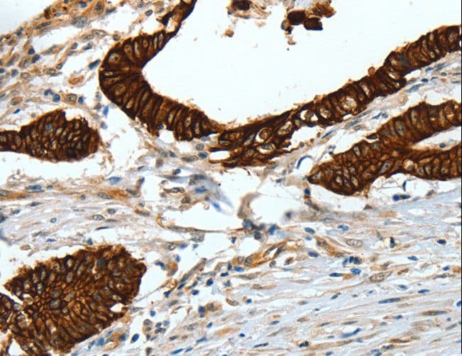 KRT18 / CK18 / Cytokeratin 18 Antibody