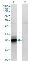 IHC-plus™ Monoclonal Mouse anti-Human ACOT9 Antibody (clone 4E4, IHC, IF, WB)