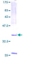 Human SPAG9 Protein (Recombinant GST)