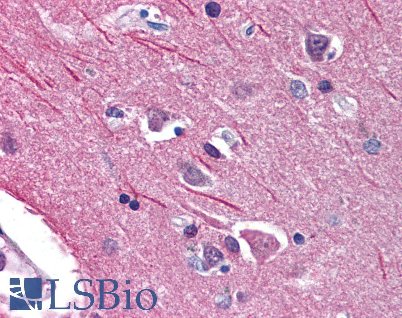 Polyclonal Rabbit anti-Human ACCN1 / ASIC2 Antibody (aa481-530, IHC, WB)