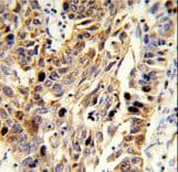 Fibulin-3 / EFEMP1 Antibody (aa119-148)
