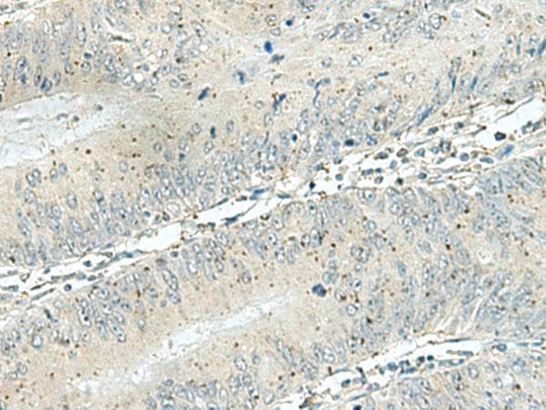 FAM116A Antibody