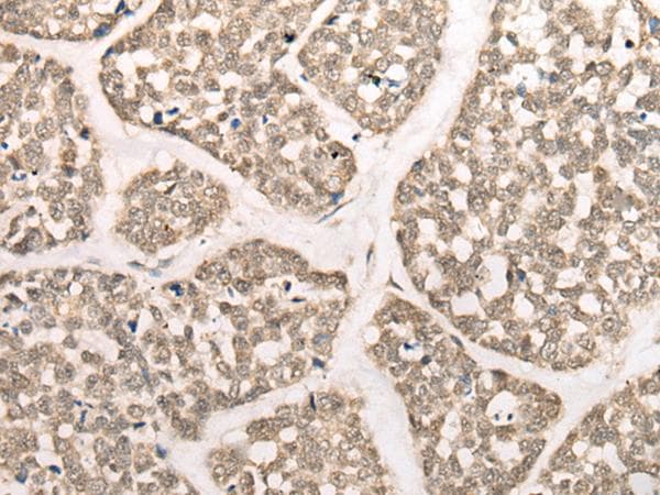 CAPN15 / SOLH Antibody