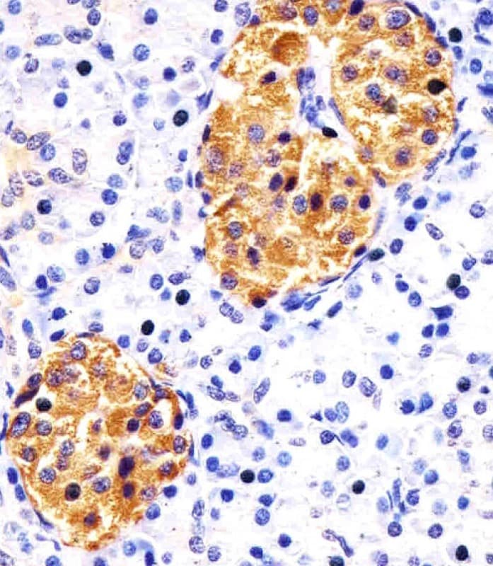 Monoclonal Mouse anti-Human RAB3B Antibody (clone 1543CT354.60.92, IHC, WB)