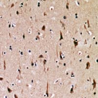 Polyclonal Rabbit anti-Human DLG1 / SAP97 Antibody (IHC, WB)