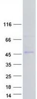 Human GNAS Protein (Recombinant Myc-DDK (Flag))