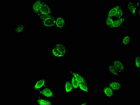 Polyclonal Rabbit anti-Human ACOX1 / ACOX Antibody (IHC, IF)