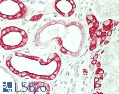 IHC-plus™ Polyclonal Guinea pig anti-Human KRT19 / CK19 / Cytokeratin 19 Antibody (IHC, IF, WB)