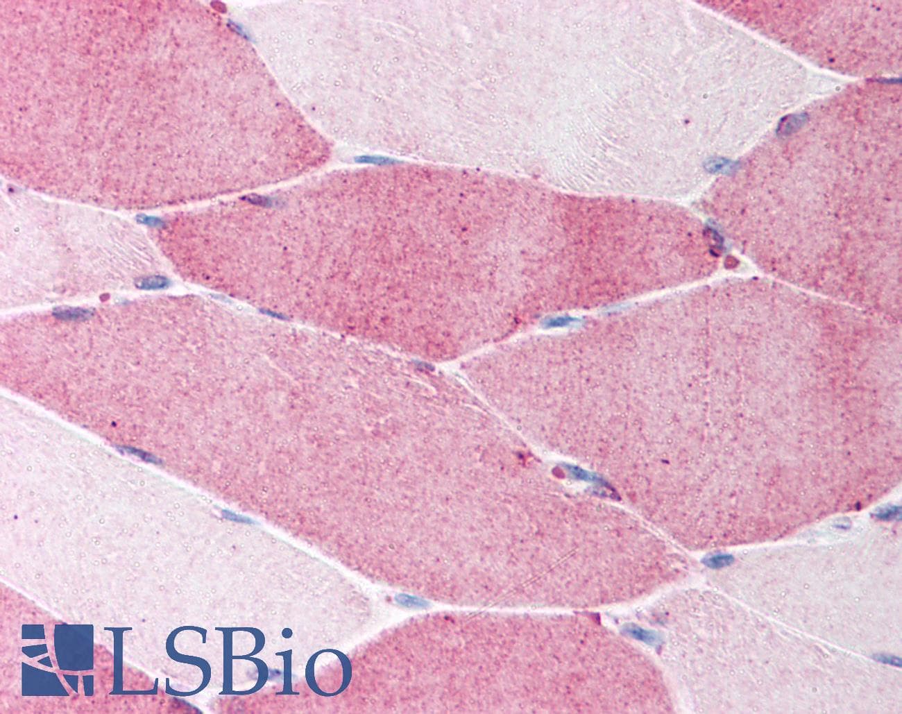 FBN1 / Fibrillin 1 Antibody (N-Terminus)