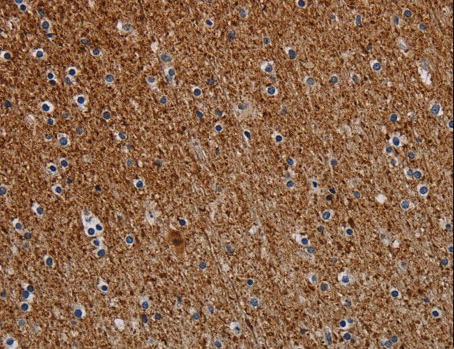 Polyclonal Rabbit anti-Human DCAF6 / NRIP Antibody (IHC)
