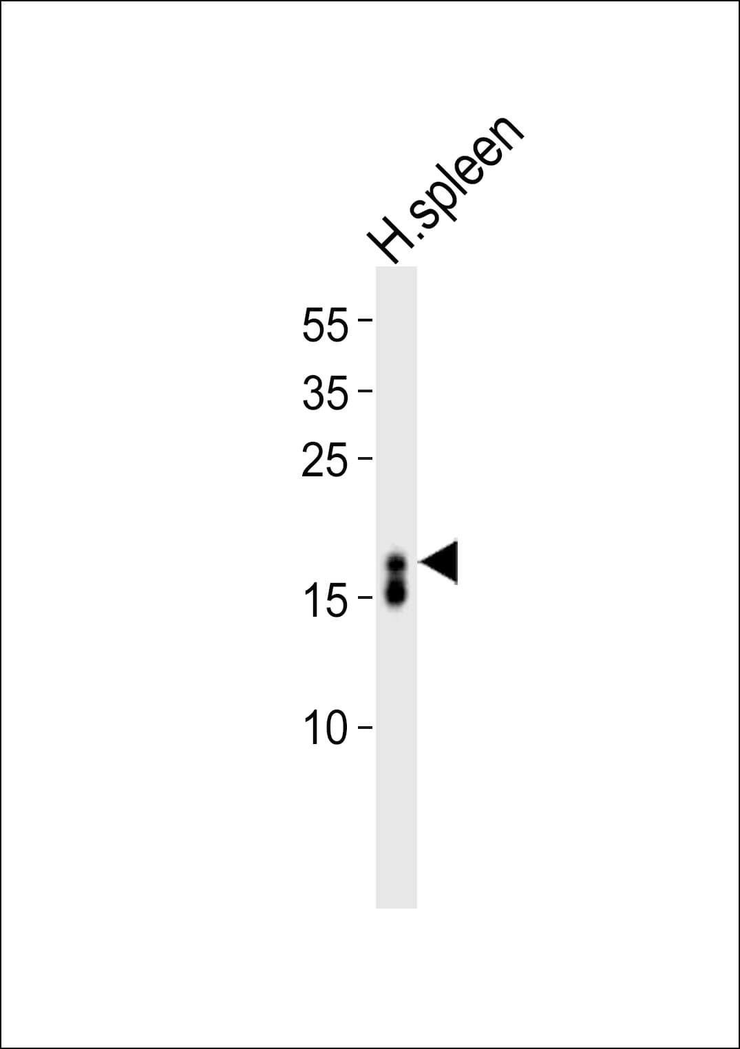 IHC-plus™ RNASE3 Antibody (aa124-151)