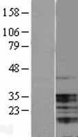 NAG20 / UBAP1 Protein (Over-Expression Lysate Myc-DDK (Flag))