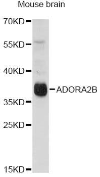 ADORA2B/Adenosine A2B Receptor Antibody