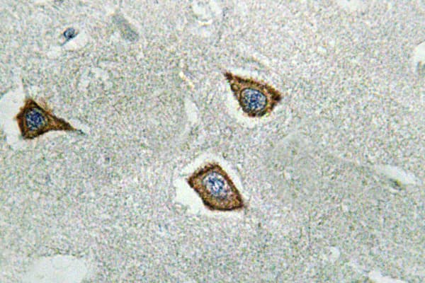 CAPN2 / Calpain 2 / M-Calpain Antibody (aa305-354)