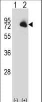 BTK Antibody (aa27-55)