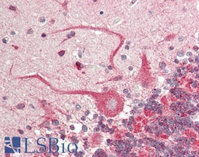 IHC-plus™ SLC6A1 / GAT-1 Antibody (aa372-421)