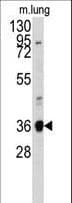 IHC-plus™ ANXA2 / Annexin A2 Antibody (aa19-49)