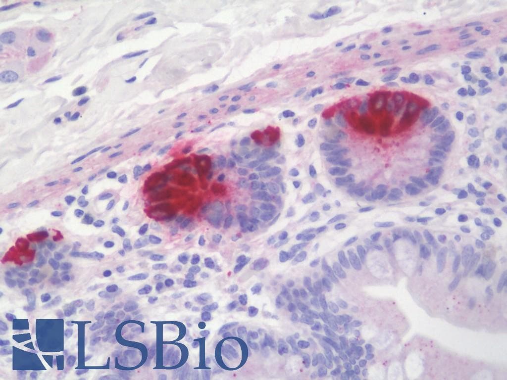 IHC-plus™ REG3G Antibody (aa89-116)
