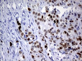 Monoclonal Mouse anti-Human MKI67 / Ki67 Antibody (clone OTI3B6, IHC)