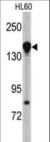 Polyclonal Rabbit anti-Human NUP155 Antibody (aa9-38, IHC, WB)