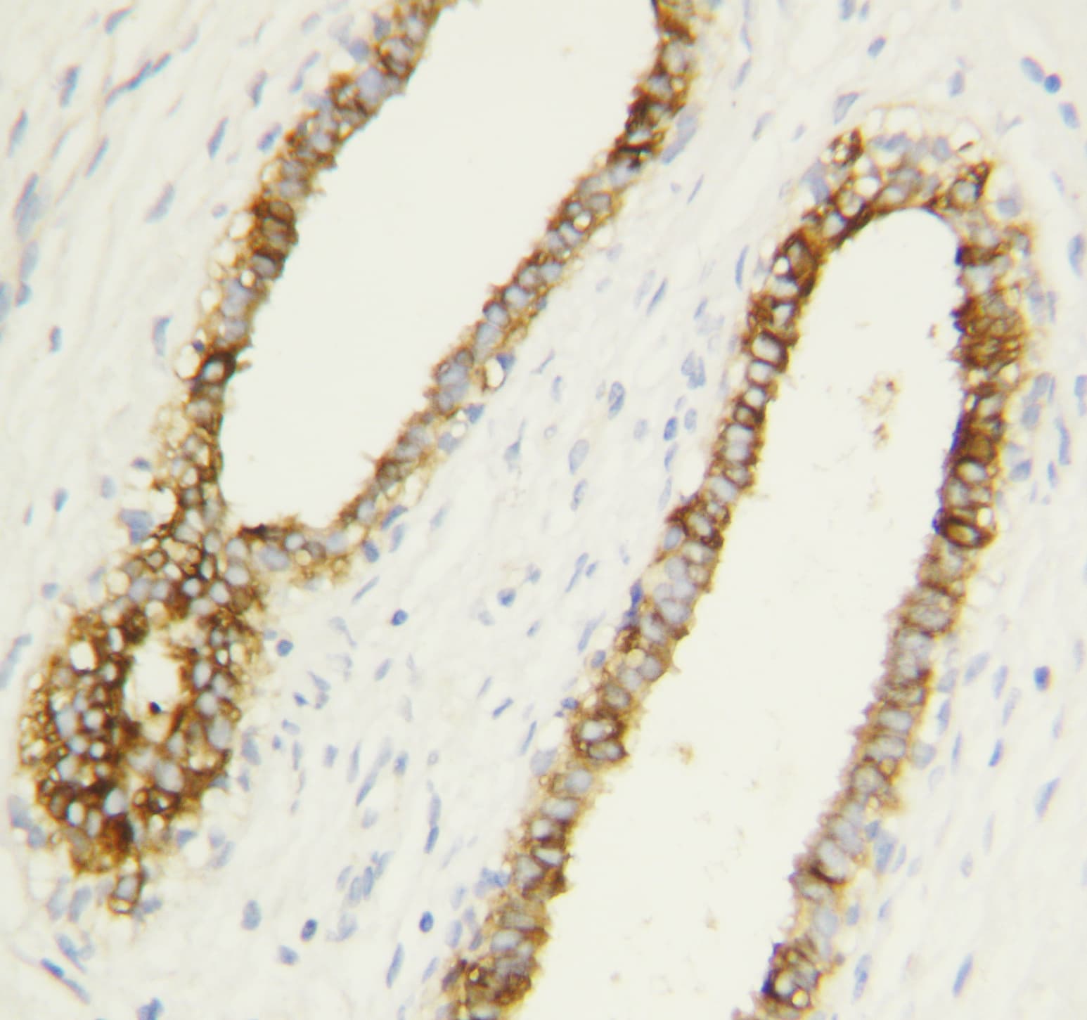 CASP1 / Caspase 1 Antibody (aa249-262)